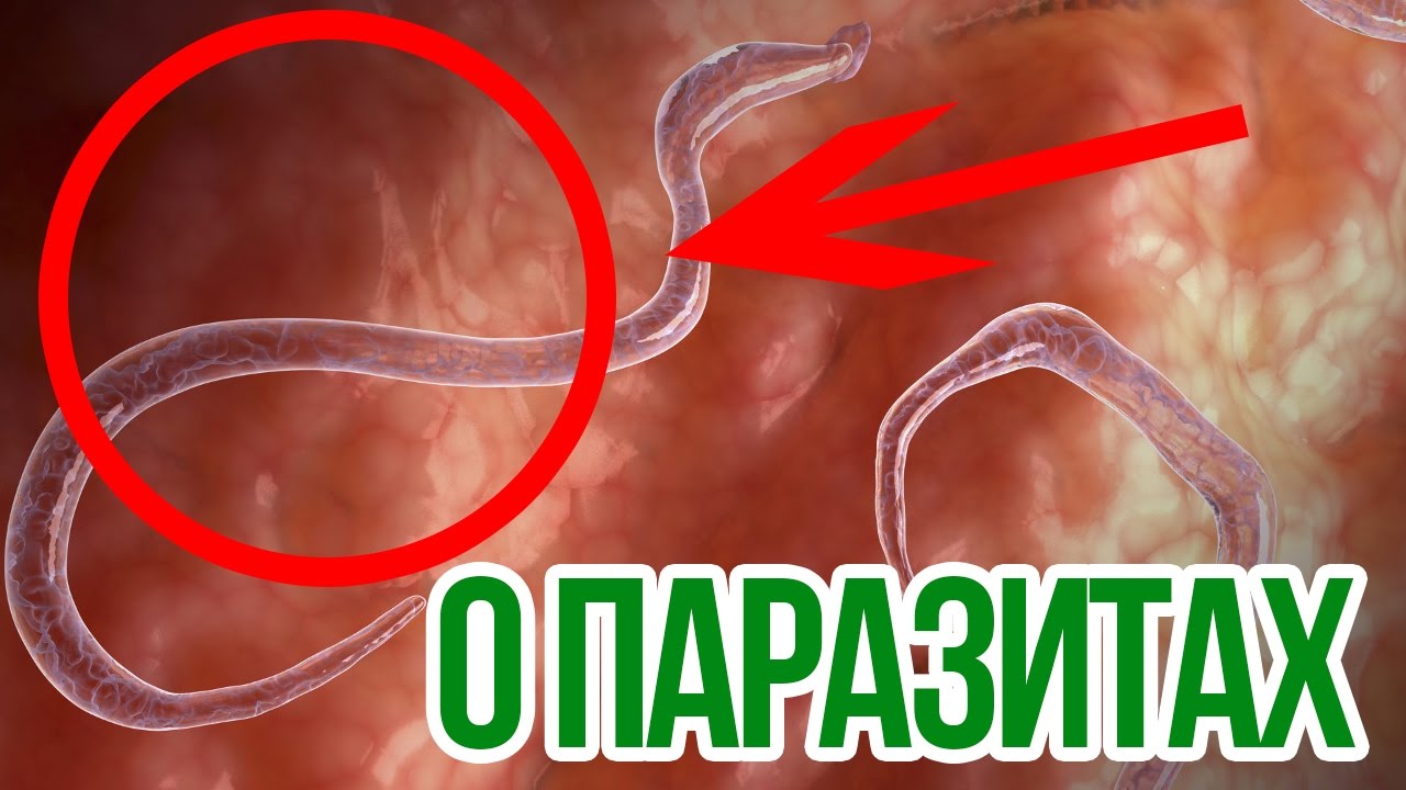 Как вылечит острицы в домашних условиях