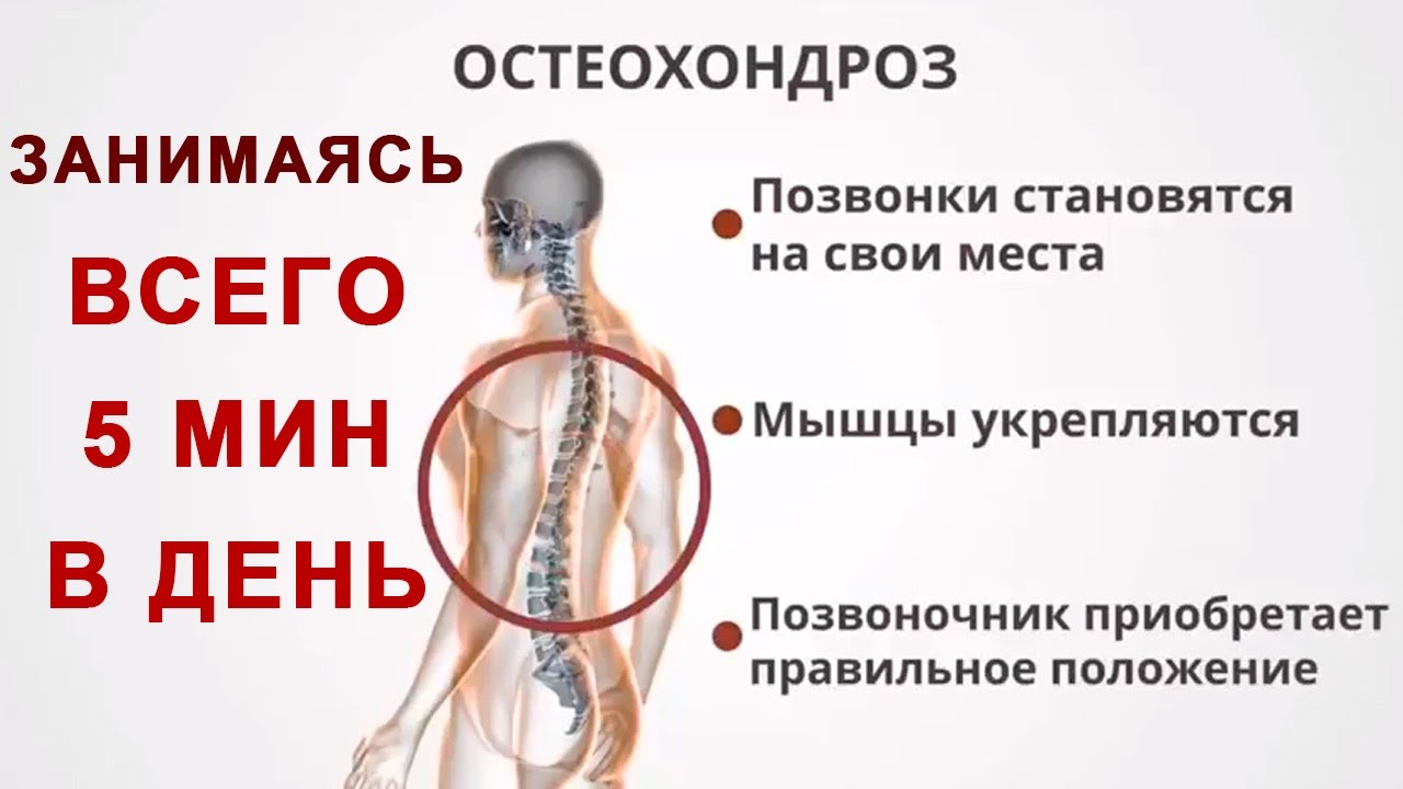 Остеохондроз симптомы лечение уколы Остеохондроз симптомы лечение уколы