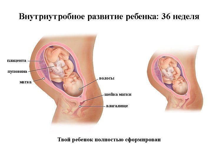 Кашель при беременности 36 недель