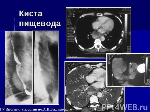 Дисбактериоз влагалища Симптомы и лечение дисбактериоза Гнойный простатит: подбираем лекарство для лечения гнойного