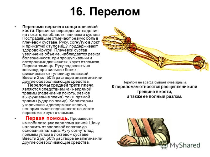 лфк для детей после перелома локтевого сустава лфк для детей после перелома локтевого сустава