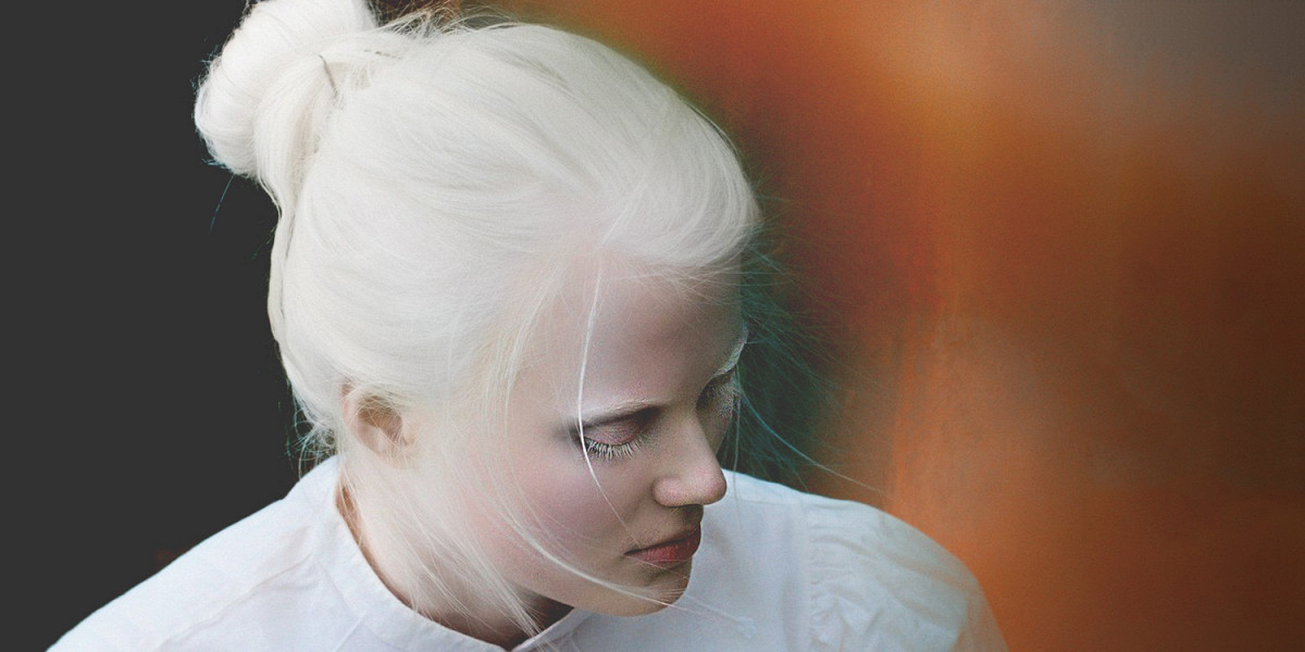 Альбиносы красивые фото и картинки