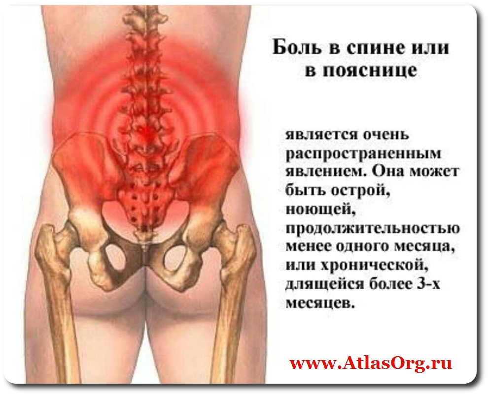 Из за чего может болеть поясница слева Из за чего может болеть поясница слева