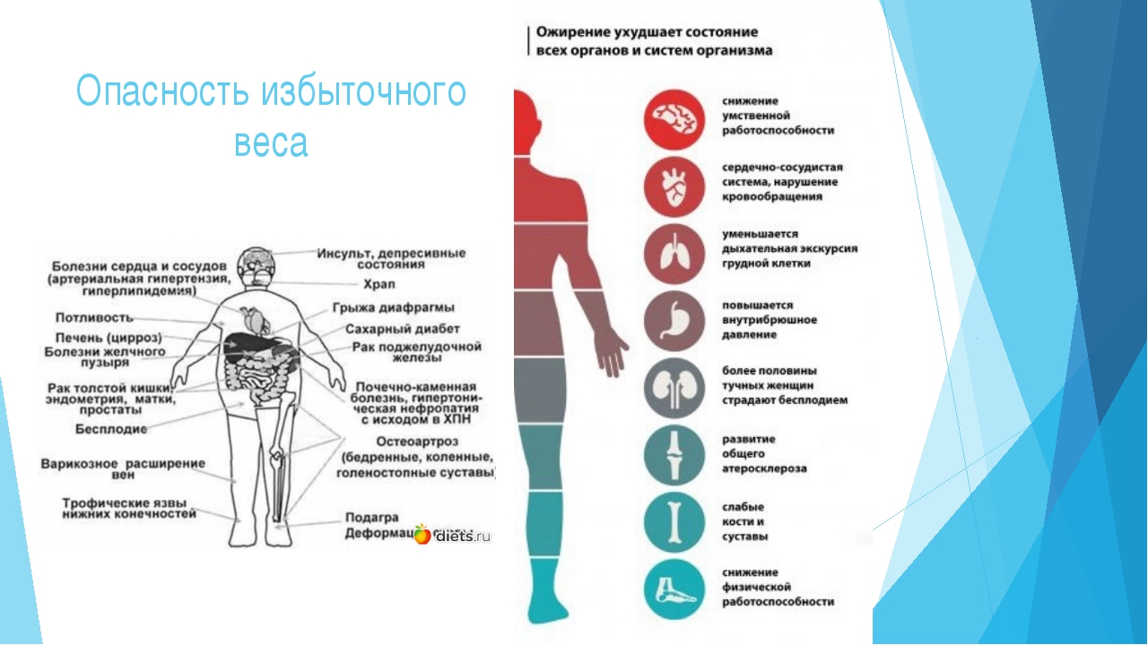 Ожирение причины с чем связано Ожирение причины с чем связано