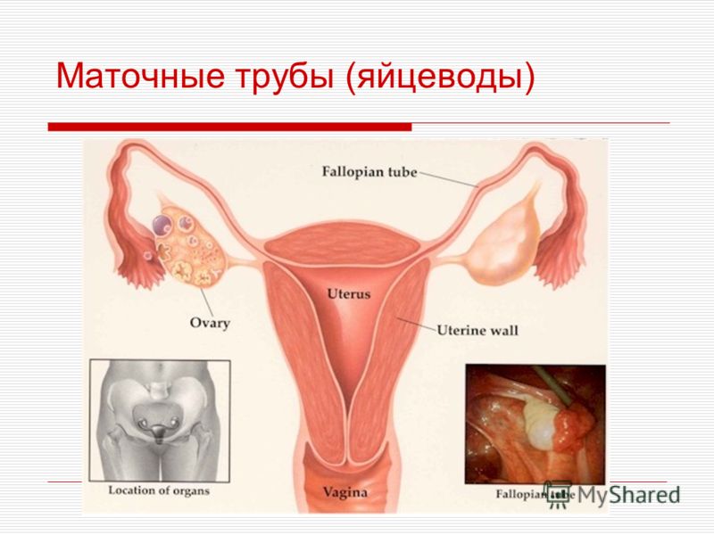 Гинекология половые женские органы