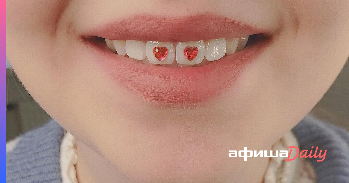 Что такое скайсы? Чем вредны стразы на зубы? - Афиша Daily