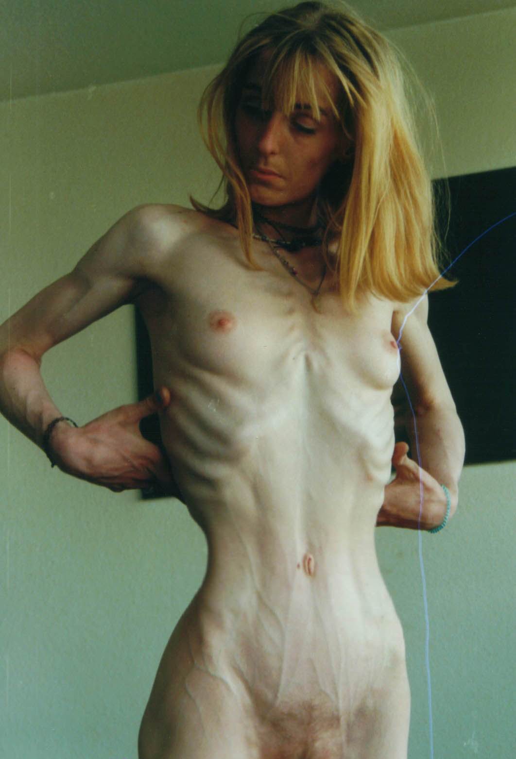 голые анорексички фото